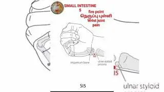 #Wrist#Joint#Paint#Acupuncture#Acupressure#point#Acu#Dr#Sumathi