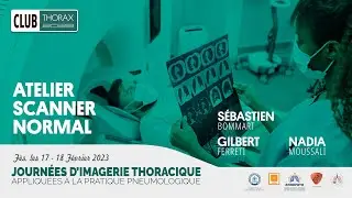 Atelier Le scanner normal
