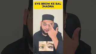 Eyebrows के बाल झड़ना #shorts #homeopathicmedicine #drsaadahmed #hairfall