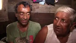 Moeder van 46-jarige man opzoek naar hulp voor haar zoon van wie beide benen zijn geamputeerd