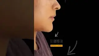 Perfilamiento facial 3D m&aacute;s l&aacute;ser - Dr. Enrique Chau