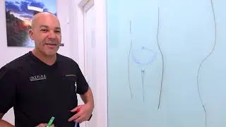 Body Contouring with Dr. Matthew Goodwin