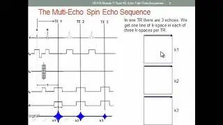 Understanding Echo Train Sequences in MRI (School of MR Essentials)