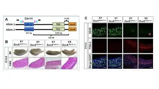 Importance de l'activation de l'expression de SOX9 par SRY
