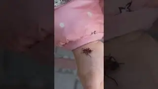 The firebug🤔🤨😗#shorts