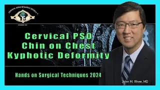 Hands On Surgical Techniques Course: Cervical PSO, Chin On Chest Deformity - Dr. John M. Rhee