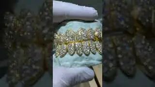 Vs1 Diamond Grillz Yellow Gold HMU inst @potion713 #vs1 #jewelry #diamonds  #fashion