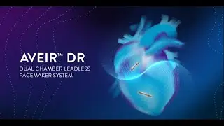 AVEIR DR&trade; Dual Chamber Leadless Pacemaker System 3D Implantation Simulation