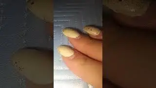💙🌸 Nail Tapping & Scratching ASMR 💙🌸 on Blue Textured Layer with Pink Sheen