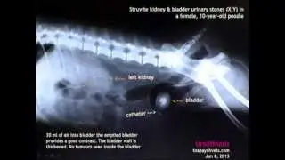 X-ray for stones