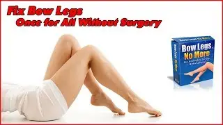 Bow Legs No More Program - How to Fix Your Bow Legs Once and For All without Surgery?
