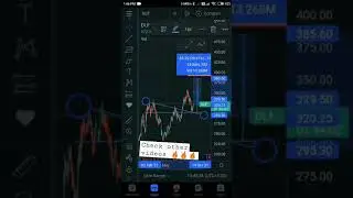 DLF share Breakout | DLF stock target | DLF share latest news today |  #shorts #sharemarket #stock