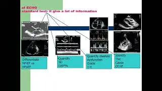 2 Test your skill NT proBNP & ECHO in ER for Pt with SOB which you will prefer