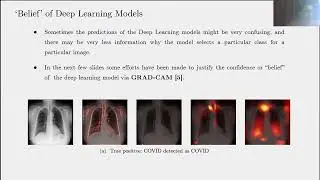 Classifying Chest X-Ray COVID-19 images via Transfer Learning