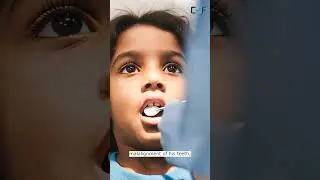 Why Kids Get Cavities Even with Good Oral Care | Coimbatore Dental Foundation