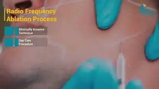Dr. Sudeep V K | Tout sur la n&eacute;vralgie du trijumeau | Apollo Hospitals