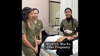 Stretch Marks After Pregnancy