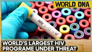US Aid Cut Triggers HIV Health Crisis, South Africa Risks Losing Ground Against HIV | World DNA