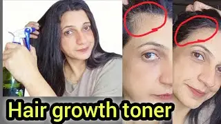 Rosemary benefits for hair | how to stop hair fall #taibascreations 
