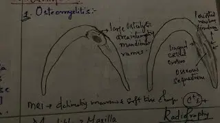 Radiolucent jaw lesions- Part 4