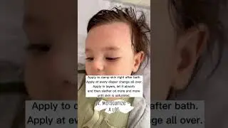 Top 10 Tips to Heal Baby Eczema