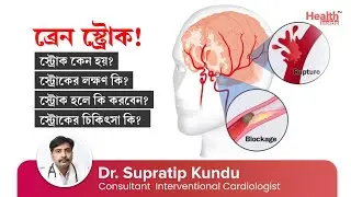 ব্রেন স্ট্রোক এর কারণ, লক্ষণ ও চিকিৎসা কি? | Stroke - Causes, Symptoms and Treatment Options