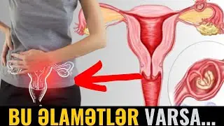 Sonsuzluğa Səbəb Olan Xəstəlik! - POLİKİSTOZ YUMURTALIQLAR SİNDROMU