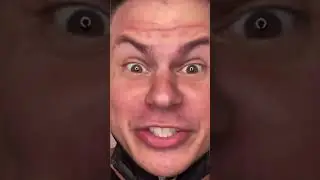 PRODENTIM  🦷BIG ALERT!🦷 ProDentim Review   ProDentim Reviews   ProDentim Oral Supplement🦷