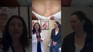 Dr. Shiva explains cherry angiomas 🍒