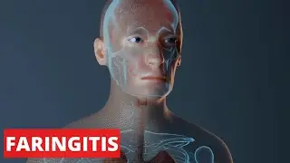 Las FARINGITIS explicada: síntomas, causas, tratamientos