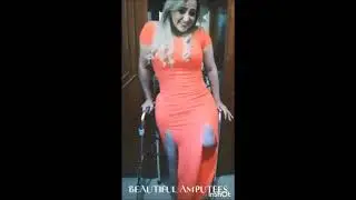 LAK amputee