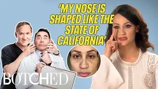 Nesreen's Deviated Septum Surgery Ended Up Making Things Even WORSE | Botched | E!
