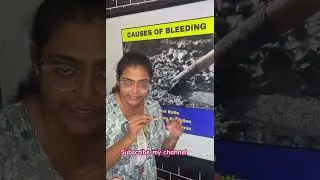 Bleeding of Concrete #civil #civilengeenring #engineersday #concrete #structuralengineering #viral