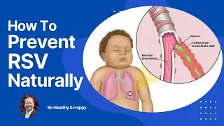 How To Prevent RSV Naturally: Holistic Solutions for Health