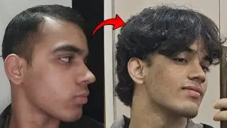 My Hairloss Reverse Routine (SOLUTION)