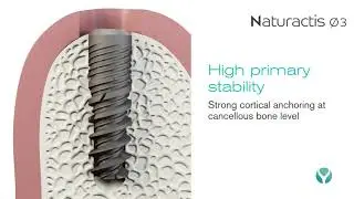Narrow Implant - Naturactis 3mm