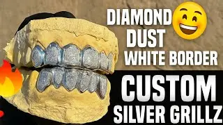 🔥 Custom Silver Diamond Dust Grillz with White Border | Shine Different