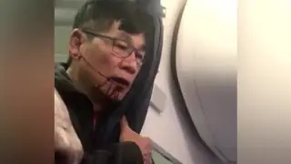 Attorney: United passenger a poster boy for us
