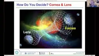 HD Analyizer - Ocular Scatter Index (OSI) for qualifying lens vs cornea in presbyopia treatment