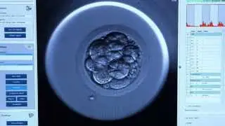 Embryoscope&trade; - CREATE Fertility