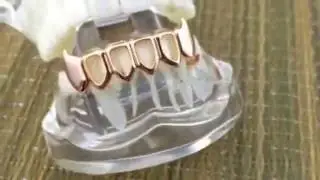 Rose Gold Plated Bottom 4 Open Face Fangs