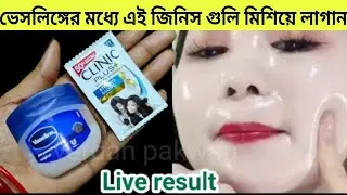 এইভাবে একবার ভেসলিন লাগিয়ে দেখুন 😱 আপনার স্কিন এতটাই ফর্সা হবে যে সবাই দেখে অবাক হবে ||