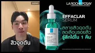 Acne reducing serum