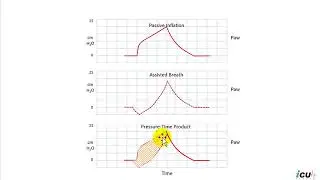 Flow Asynchrony on Volume Controlled Mechanical Ventilation