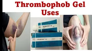 Thrombophob Gel uses| When to use | How to use