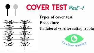 Cover test- Part 1 | Types of cover test | Cover | uncover| Alternate cover