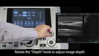 Edan AX3 Ultrasound Machine - User /Setup Operation Video