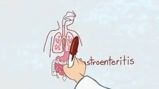 What is Stomach Flu?