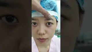 Mắt lồi nền cắt m&iacute; như thế n&agrave;o để cải thiện? | B&aacute;c Sỹ H&ugrave;ng Thanh - Thẩm Mỹ GN