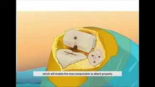 Virtual Knee Surgery 👾 Flash Game (2007) FULL Gameplay